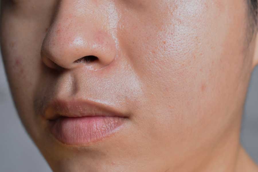 Close up of woman with oily skin type